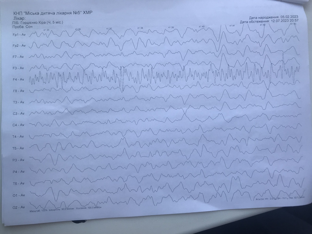 4F3FD348-041C-4691-93E9-D4FF5A120CAF