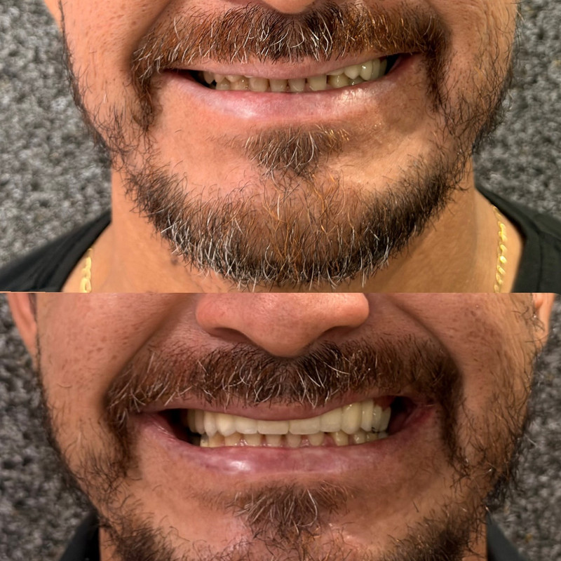 Dental Clinic - Procedimento