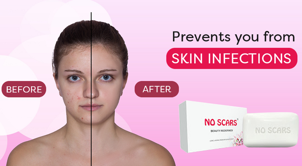 No scars soap for mens