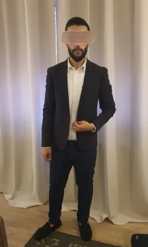 Patient after losing 134KG