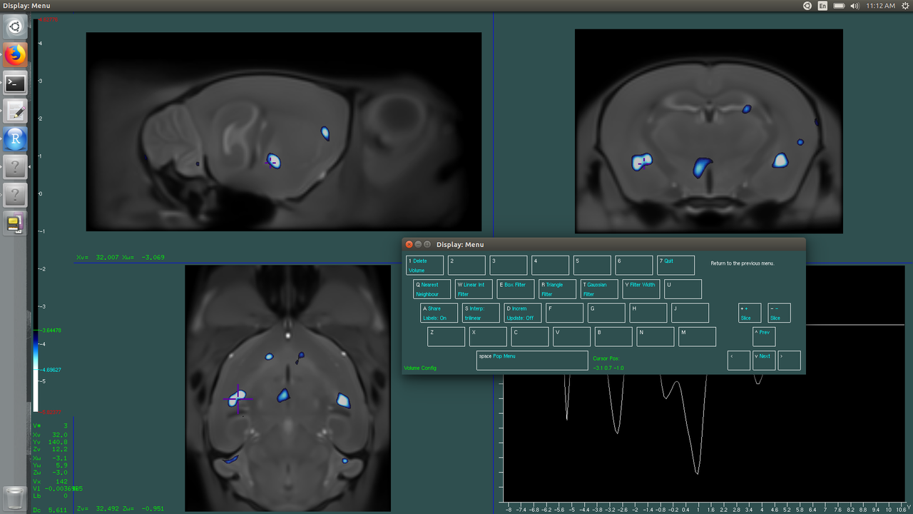 Final visualization
