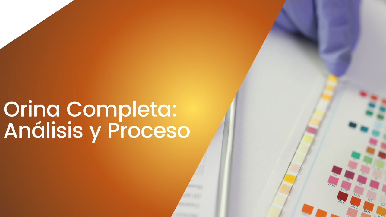 Curso Proceso y Análisis de Orina