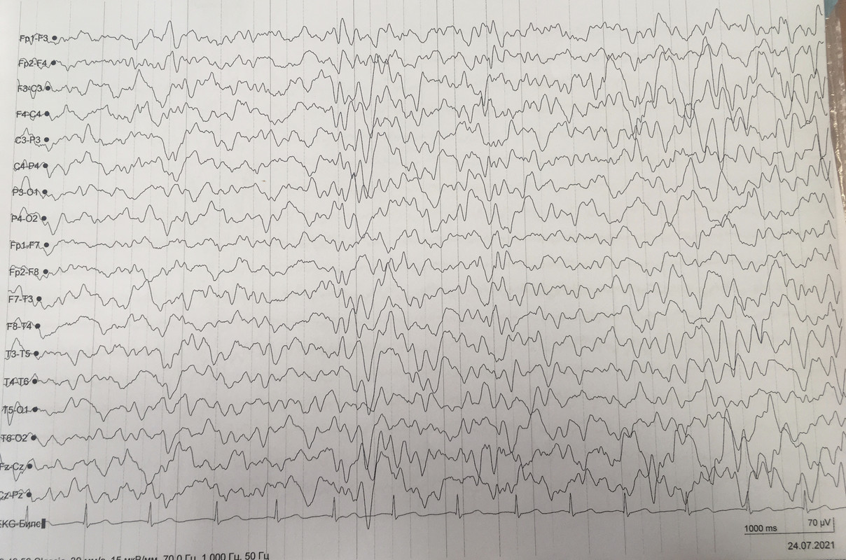 BA398739-E897-4E53-86B5-B438E6D0119D