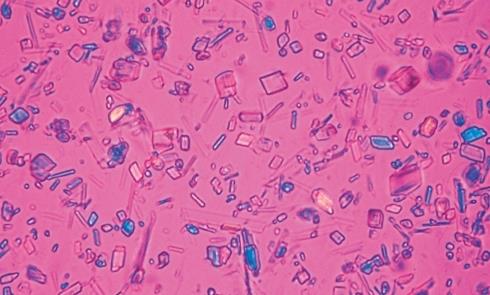 Rheumatology question 2 image