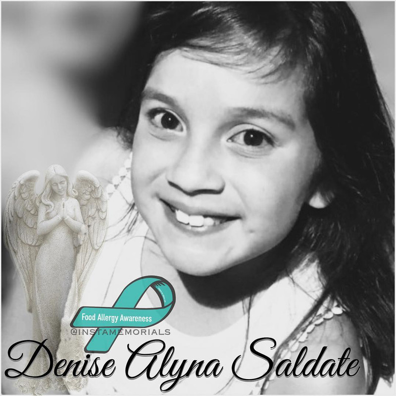 Denise Saldate yang meninggal karena alergi pasta gigi