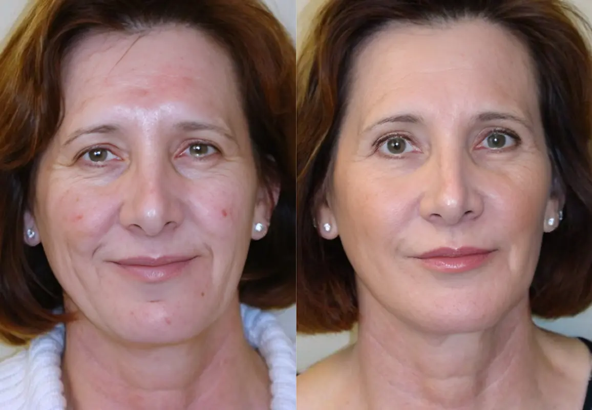 Skin Health Video