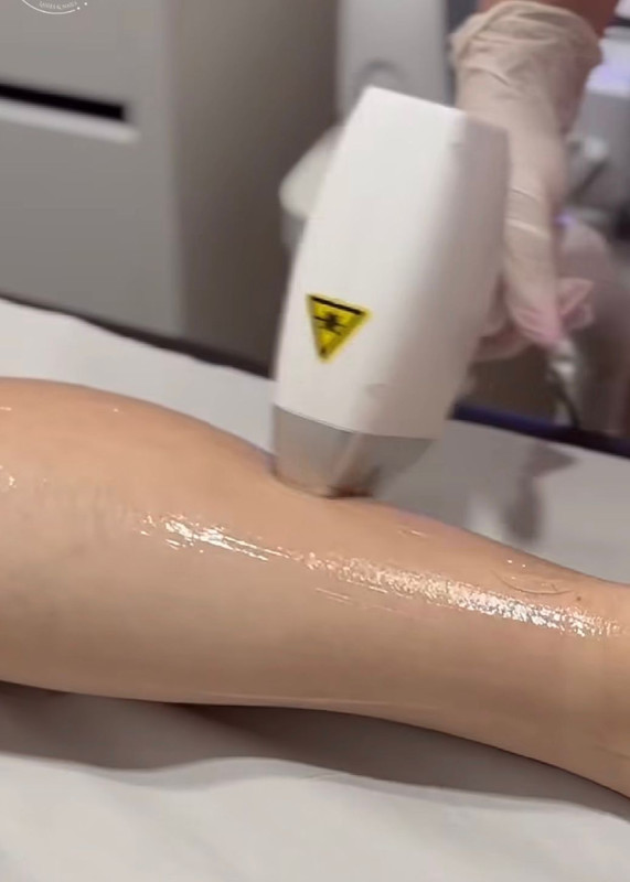 [Imagem de depilação profissional]