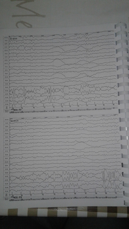 15105226433481067032728