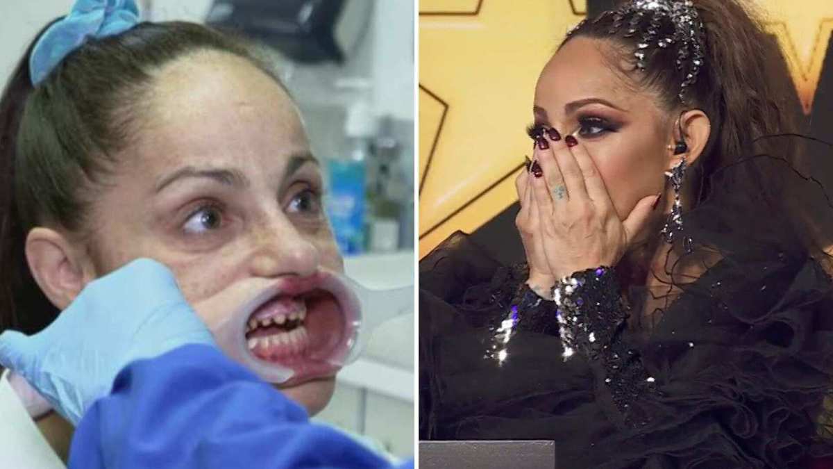 Lolita Cortés confesó que un doctor le destrozó la dentadura