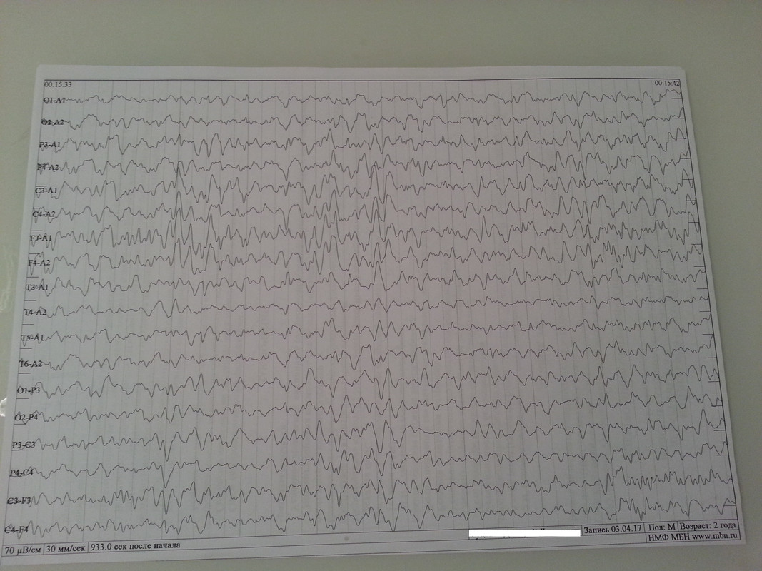 ээг 2 года с.2