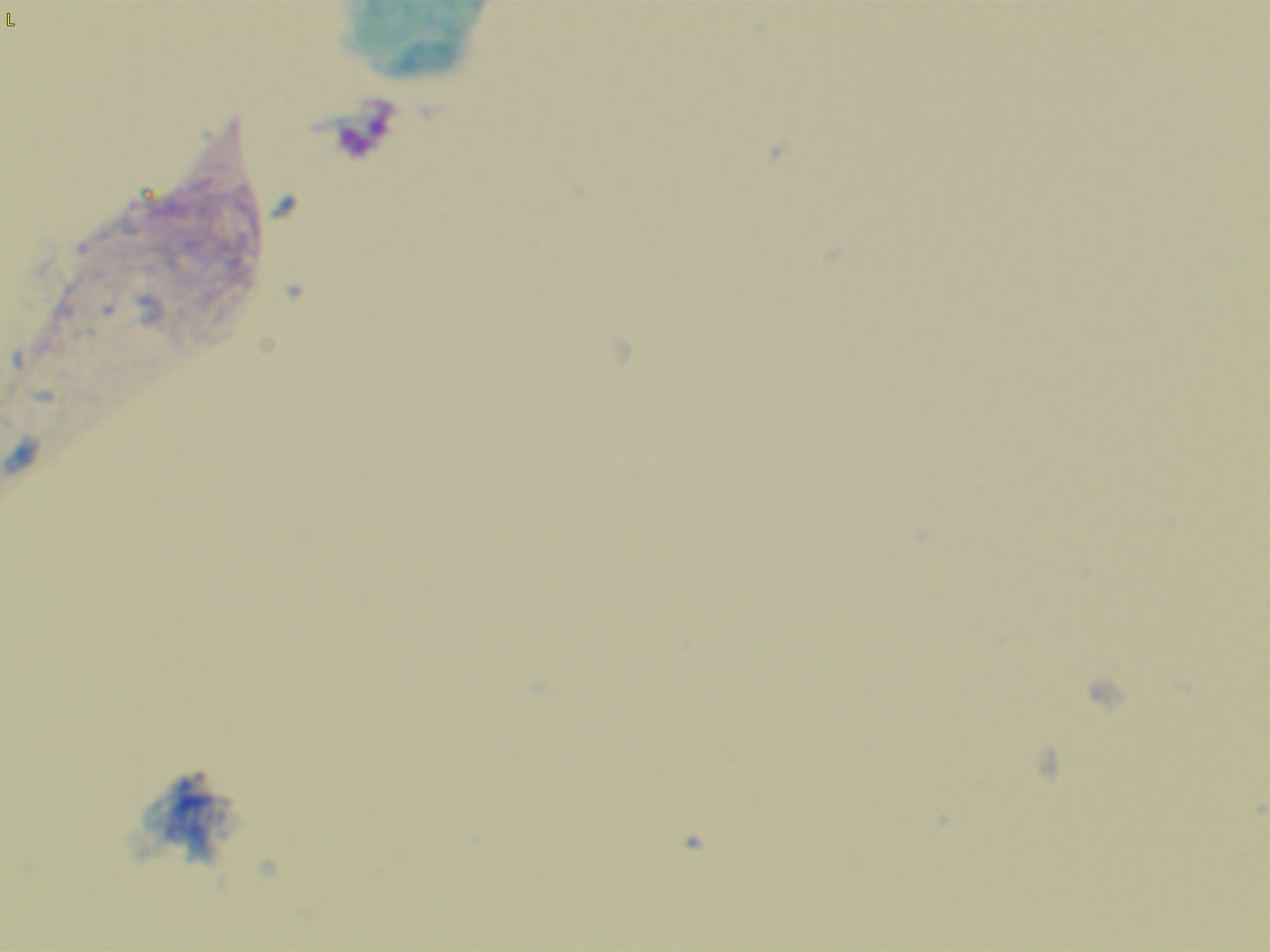 23207 177263 Into CNS 000005