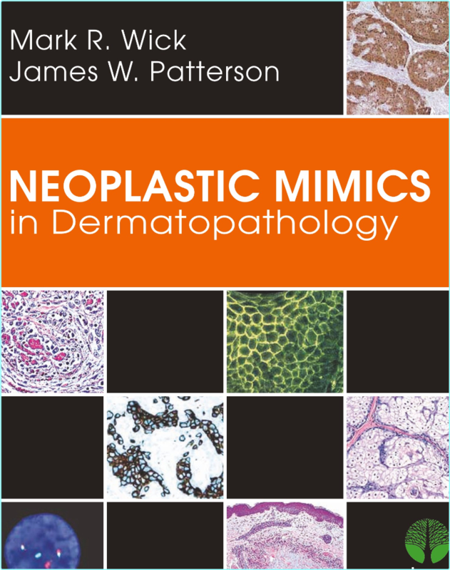 Wick M Neoplastic Mimics In Dermatopathology 2013