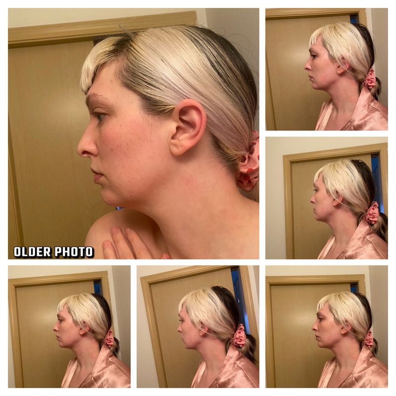 5A22593E-DB3A-4A62-9192-E5DC6025EE5B-COLLAGE