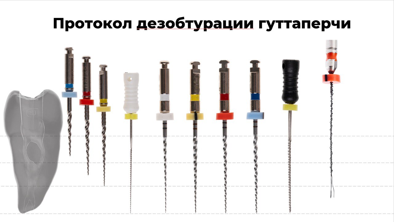Схема протокола дезобтурации корневого канала