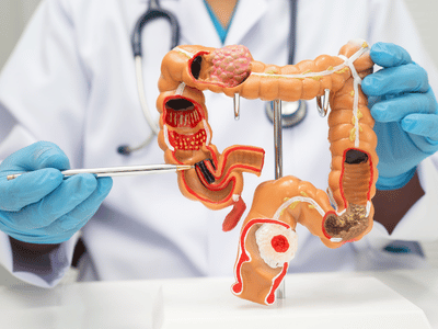Gastroenterologists