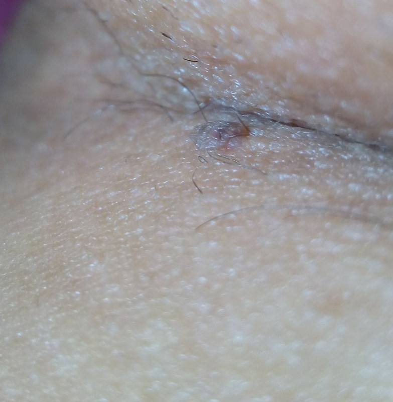 IMG-20191115-205748-816.jpg