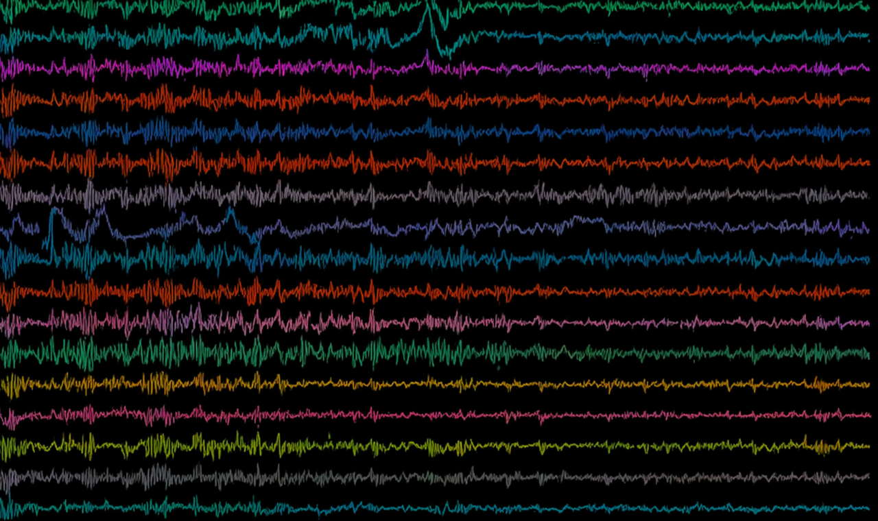 EEG-gestützte Einblicke