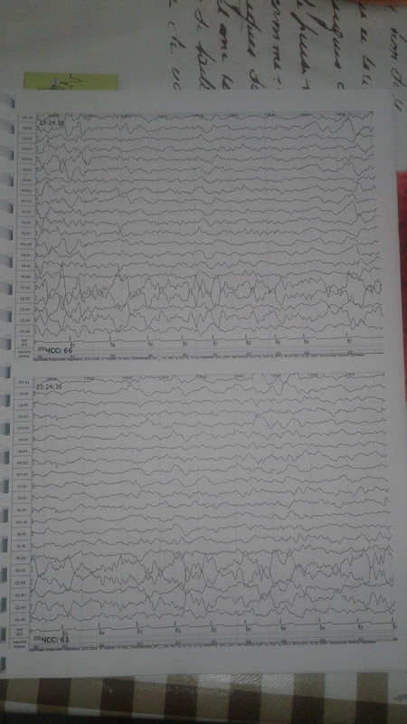 15105228854021289096111