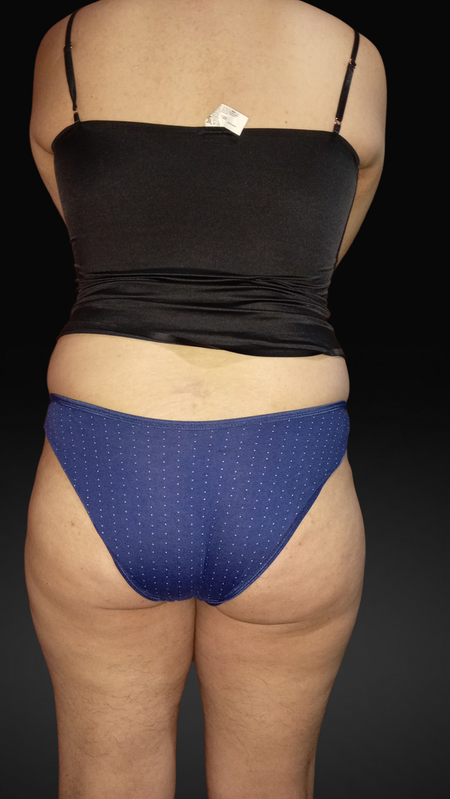 femboy culon