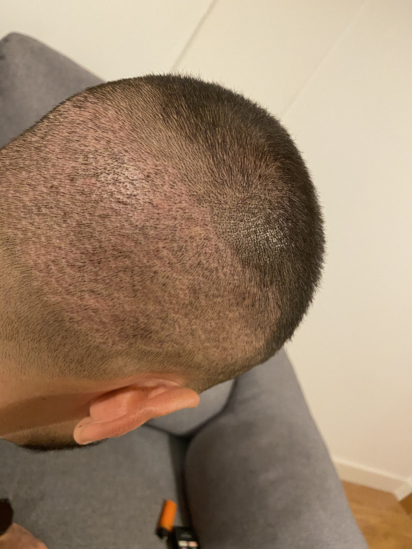 9115C048-53CB-45B8-BE50-45B5ED39A487