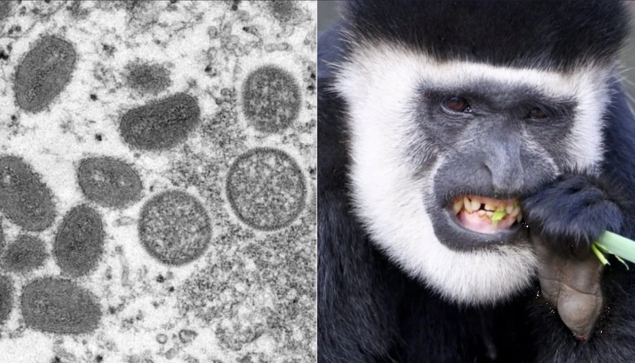 Aparece primer caso en humanos del MORTAL VIRUS B, ¿qué tan letal es?