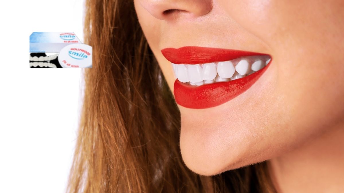 Hollywood Smile