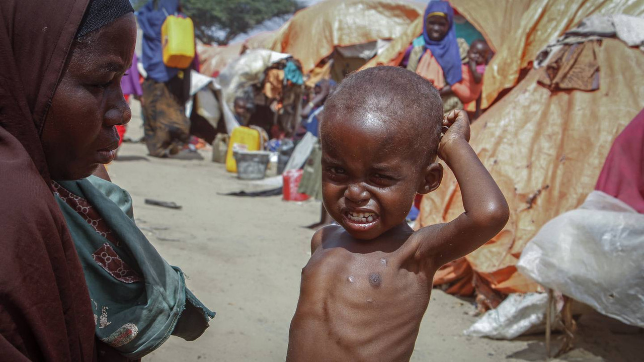Somalia: la desnutrición está matando a cientos de niños, dice la ONU
