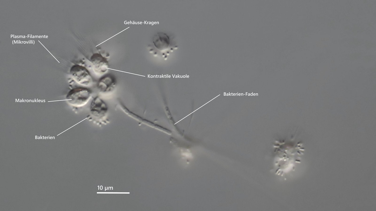 Codonocladium (ev) sp Stiel-Flag (Kreutz 53) oder Codonosiga DIK 100-Z7
