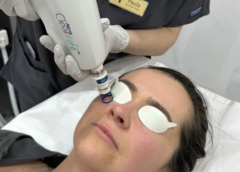 ClearLift treatment at Let's Face It Med Spa in Denver.