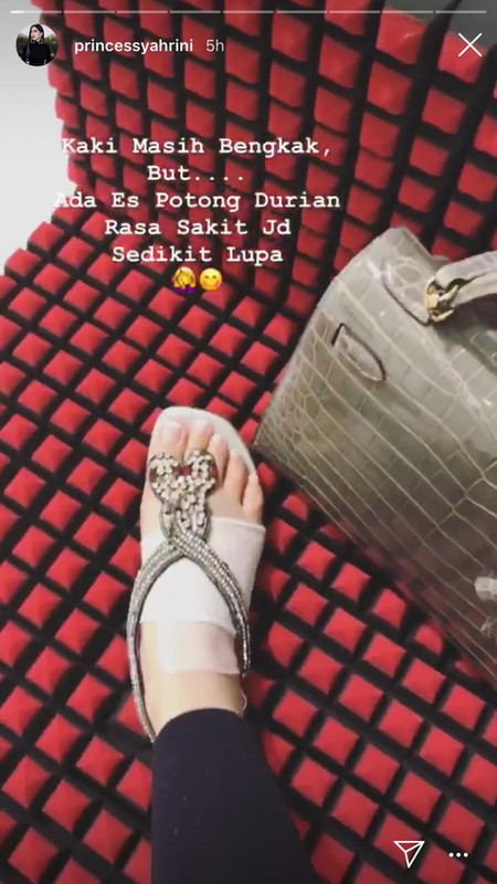 Keadaan terkini kaki Syahrini (Instagram @princessyahrini)