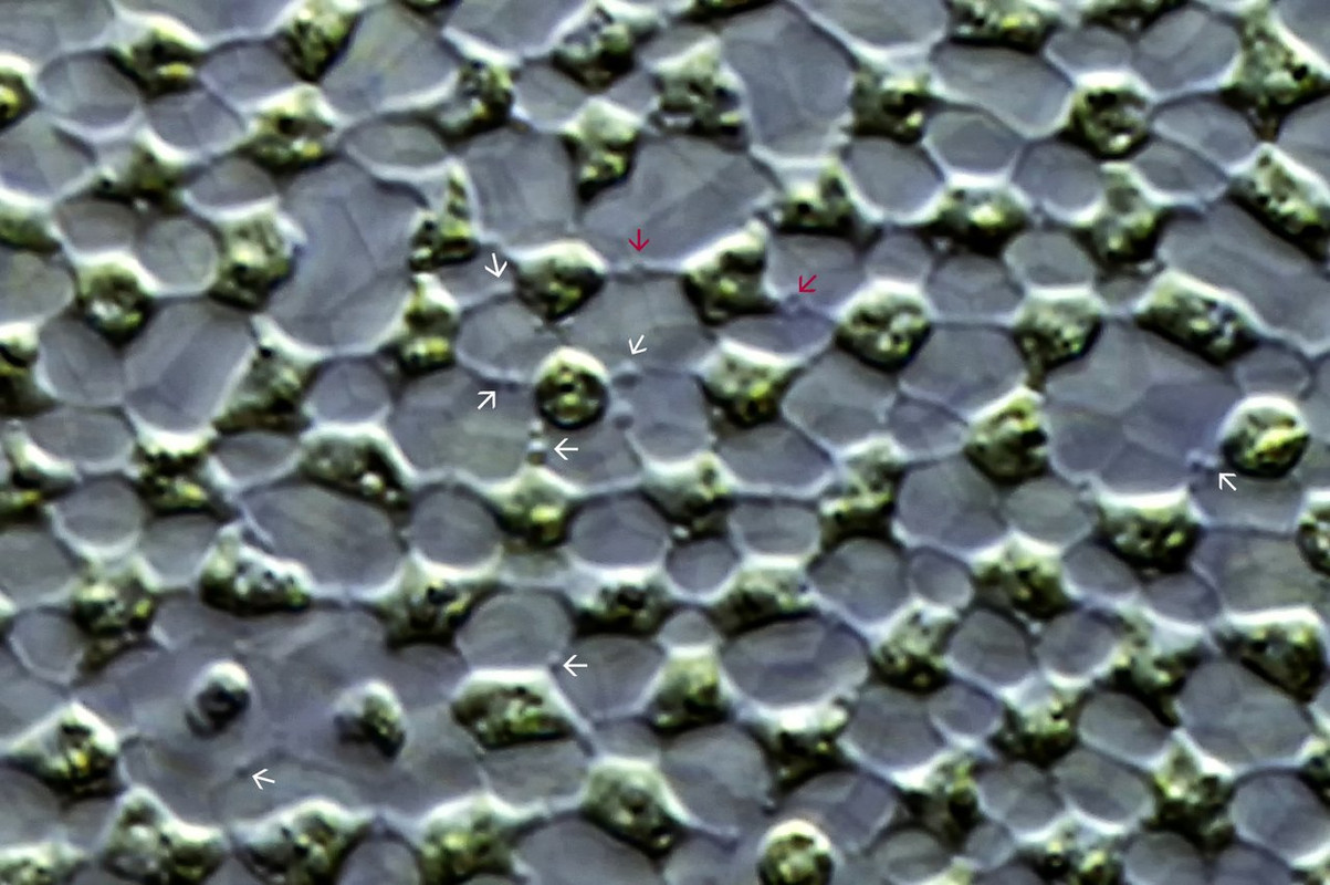 Volvox 17 globator Wimperkugel Große Plasmabrücken mit Vesikel DIK 50