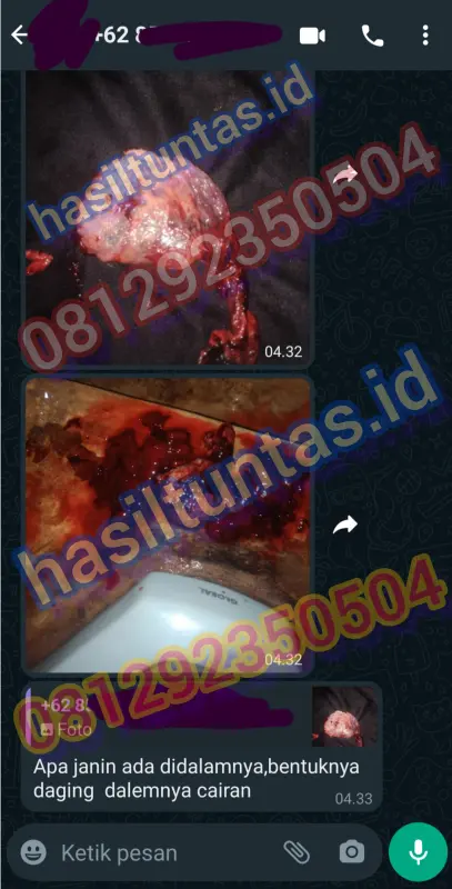 aborsi-cytotec-lebak