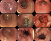 tranny inside neovaginas