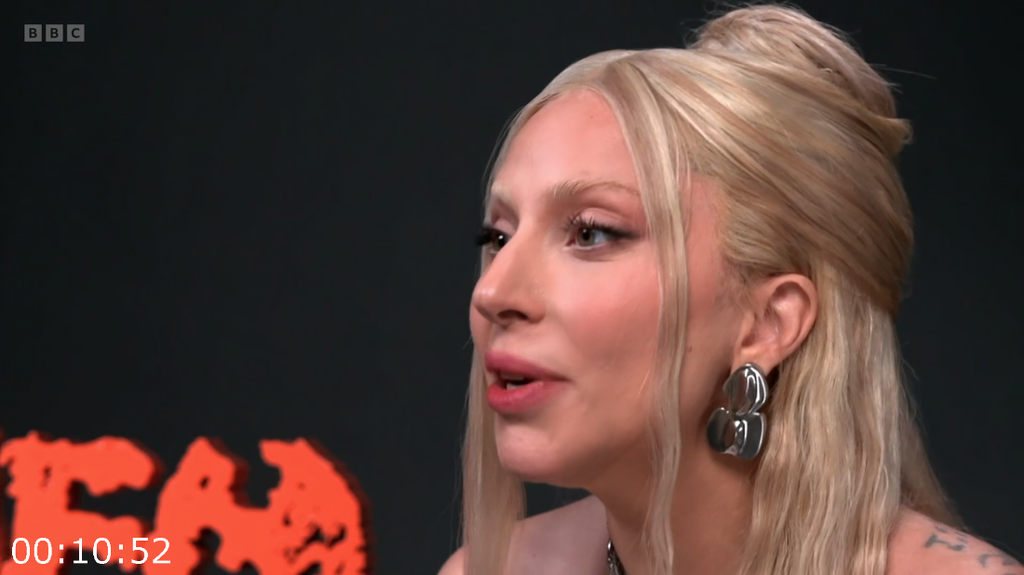 [Image: 24kn6hcgb2jv.png]