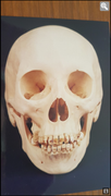 Jane_Doe_skull