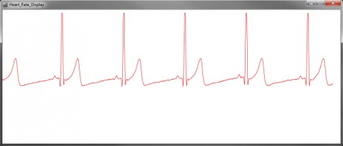 Heart-Rate-Normal