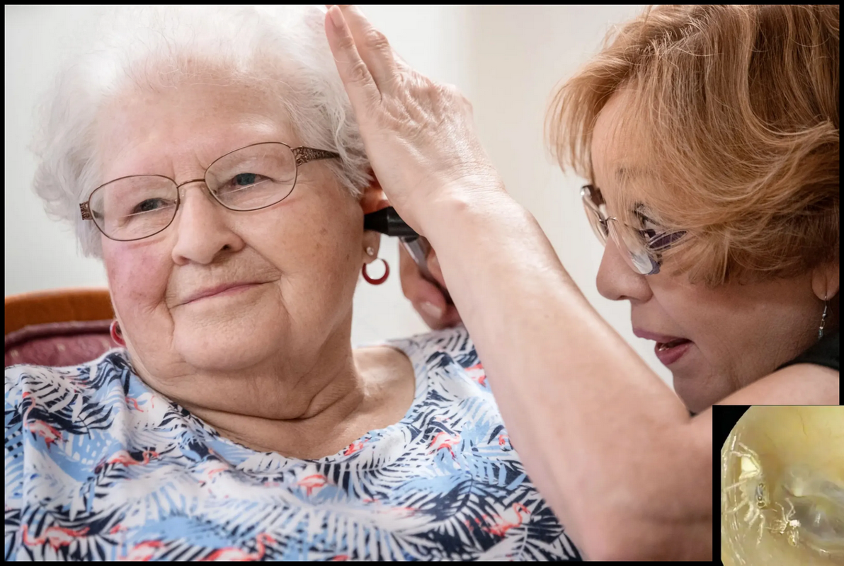 Extraen del oído de una mujer una araña, luego de que oía crujidos