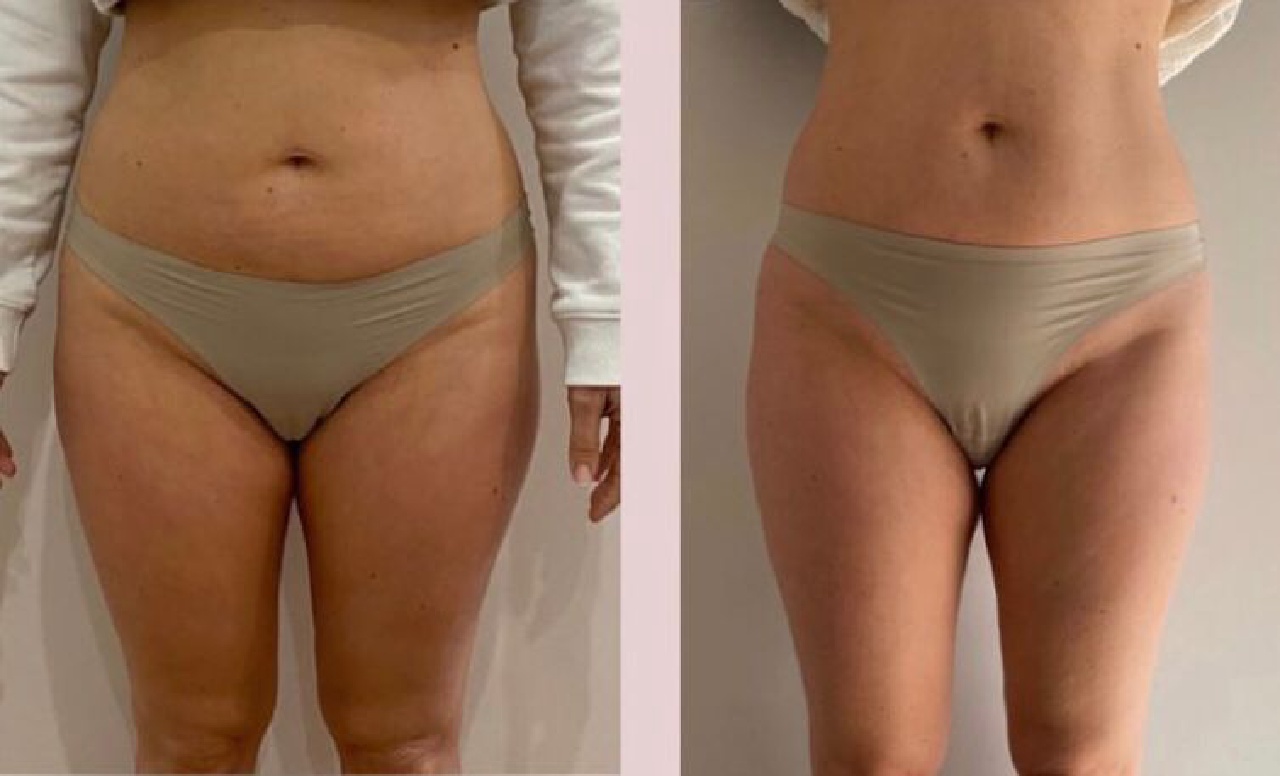 Projeto 13