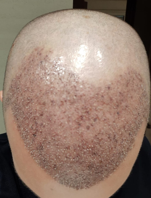 10 DIA 2