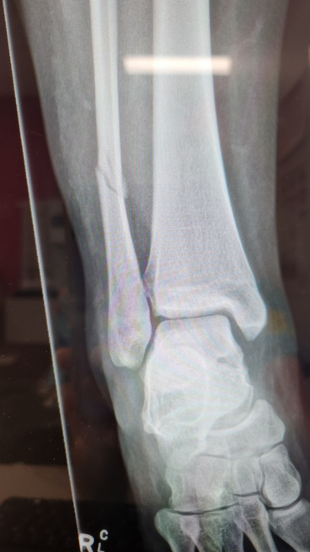 Screenshot 20260216 211630 Photos