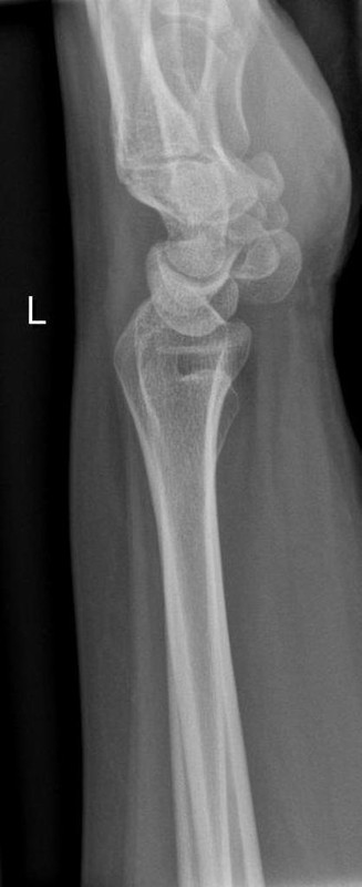 Orthopedics question 2 image