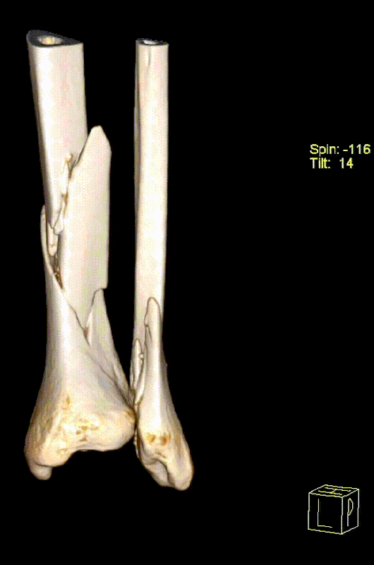 18 12 25 gleženj d vrt range 2 edit