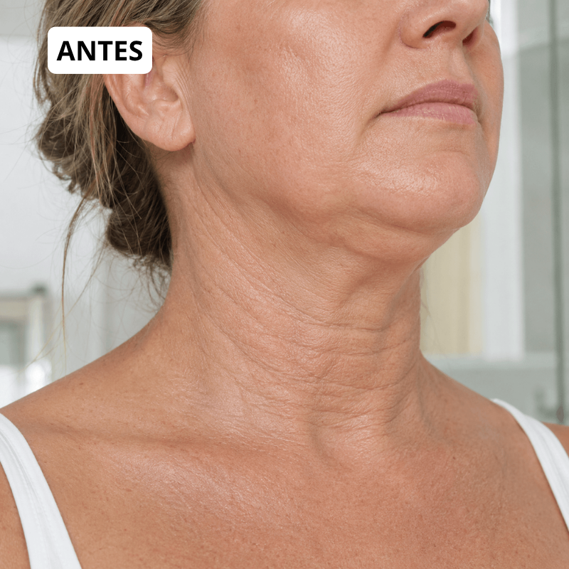 Antes