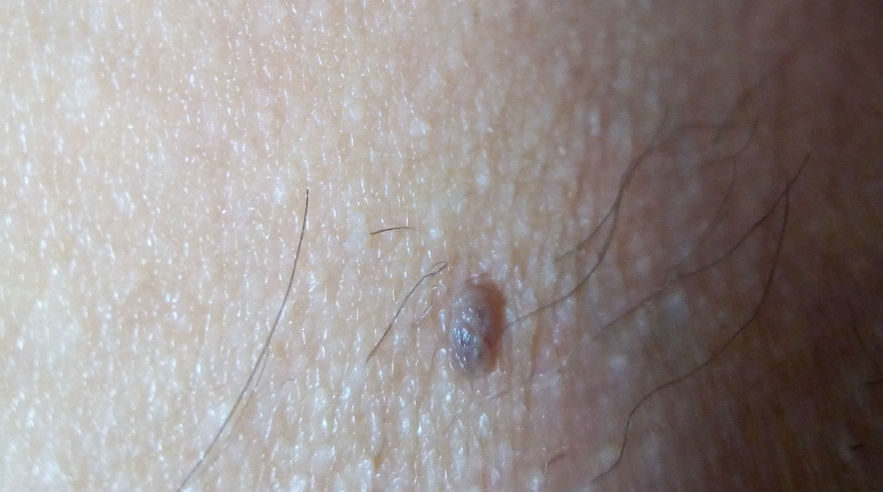 IMG-20191115-205551-996.jpg