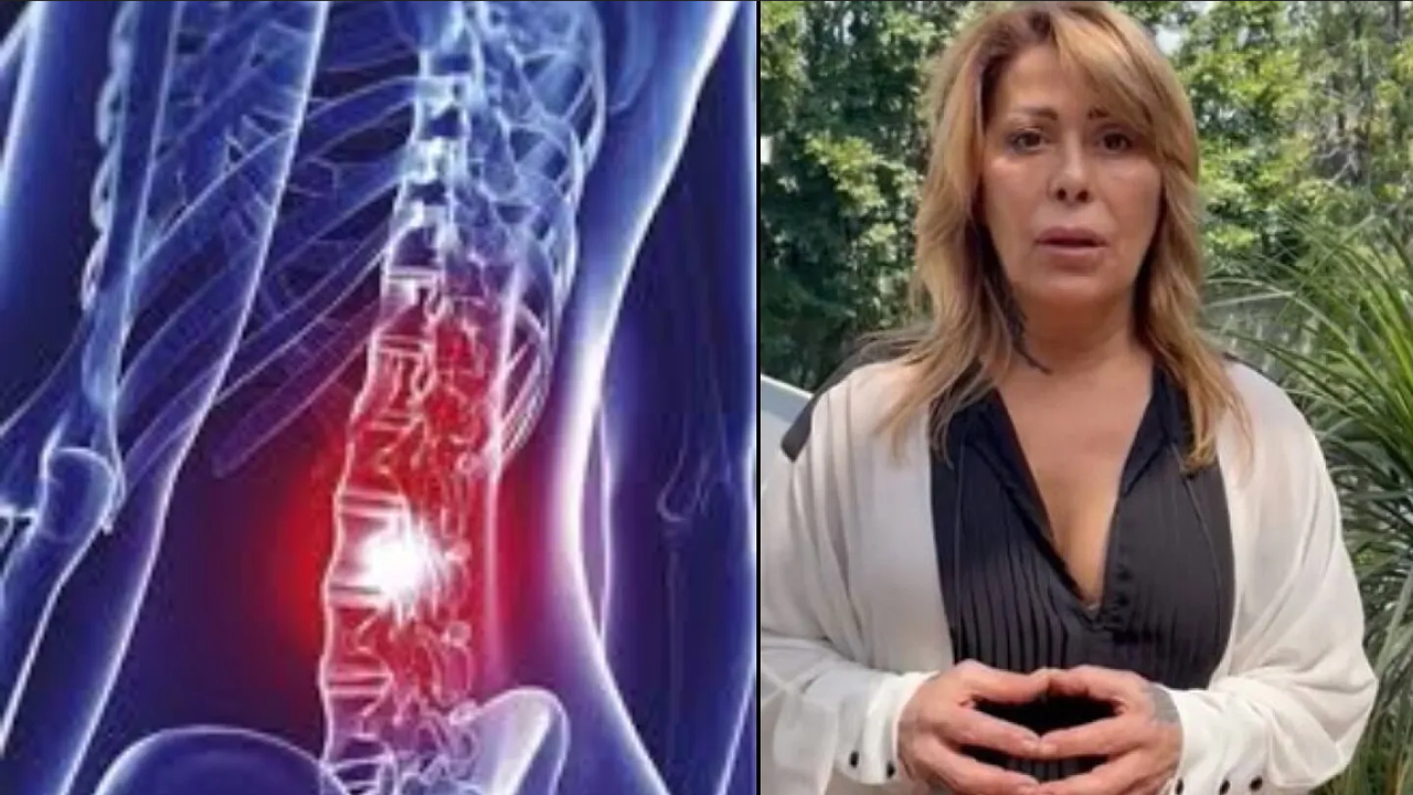 ¿Síndrome compresivo radicular? afección que dejaría paralítica a Alejandra Guzmán