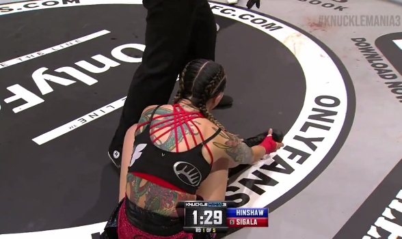 Боксьорка опита да намести счупения си крак, за да продължи да се бие