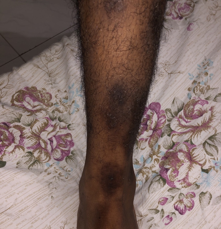 7A2D2B6B-F7C8-4460-A51A-7C29B6CCF355