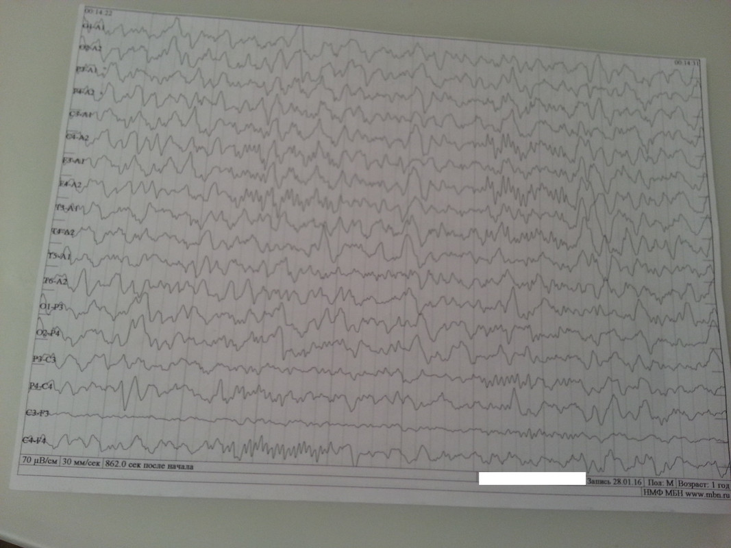 ээг 1 год с.2