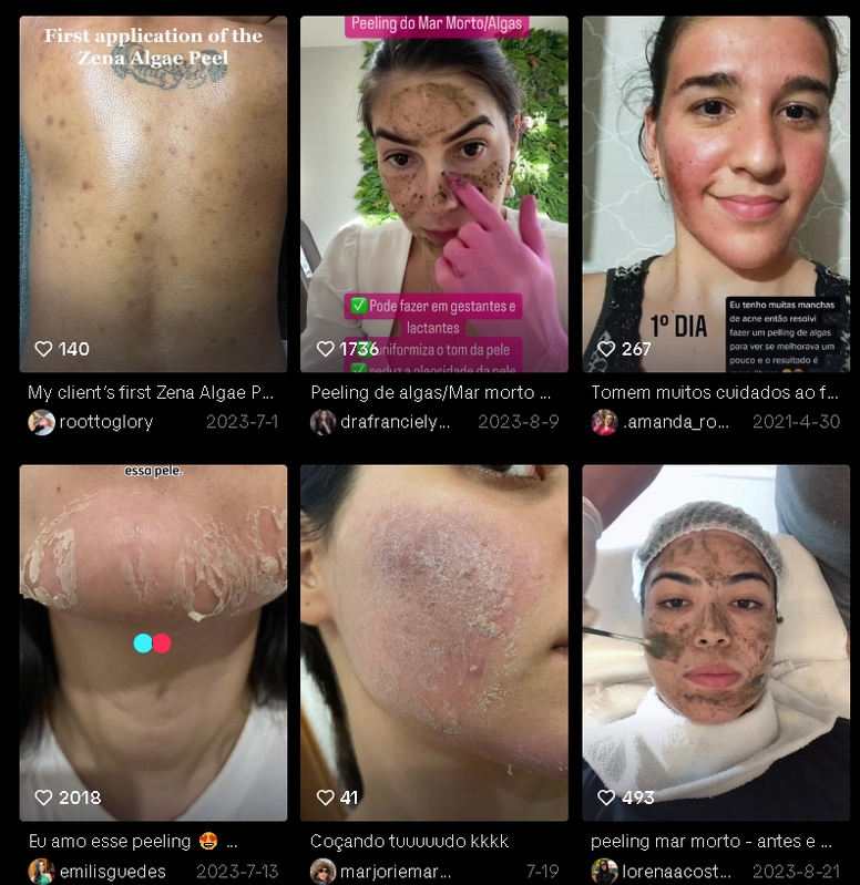 Depois do peeling