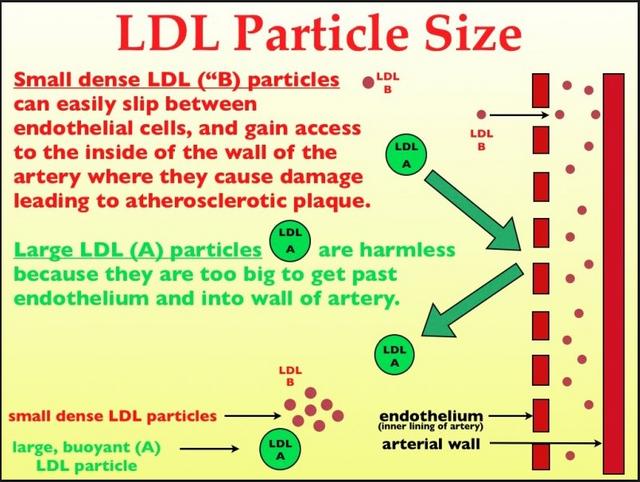 LDL-Particles.jpg